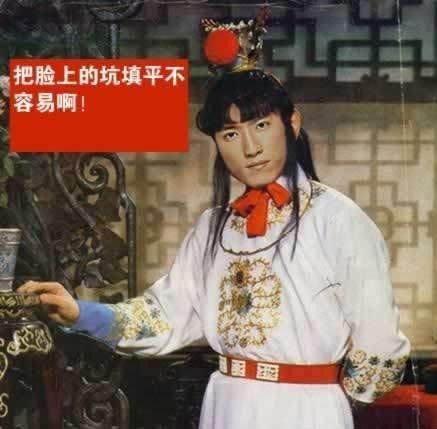 刘翔版：把脸上的坑填平不容易啊！